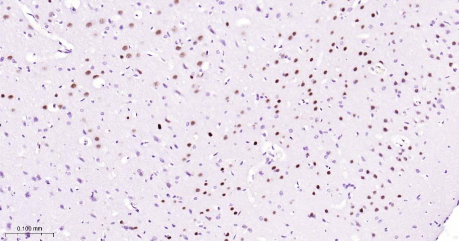 DNA结合蛋白2重组兔单抗