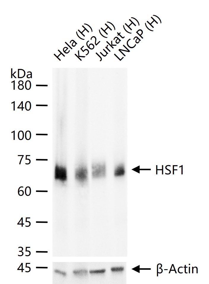 热休克因子1重组兔单抗