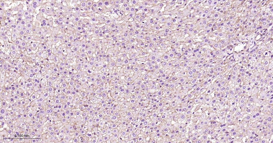 β-连环蛋白/β-连环素/β链接素重组兔单抗