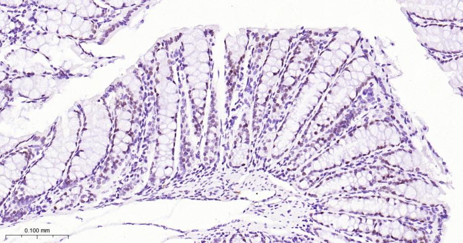 DNA结合蛋白2重组兔单抗
