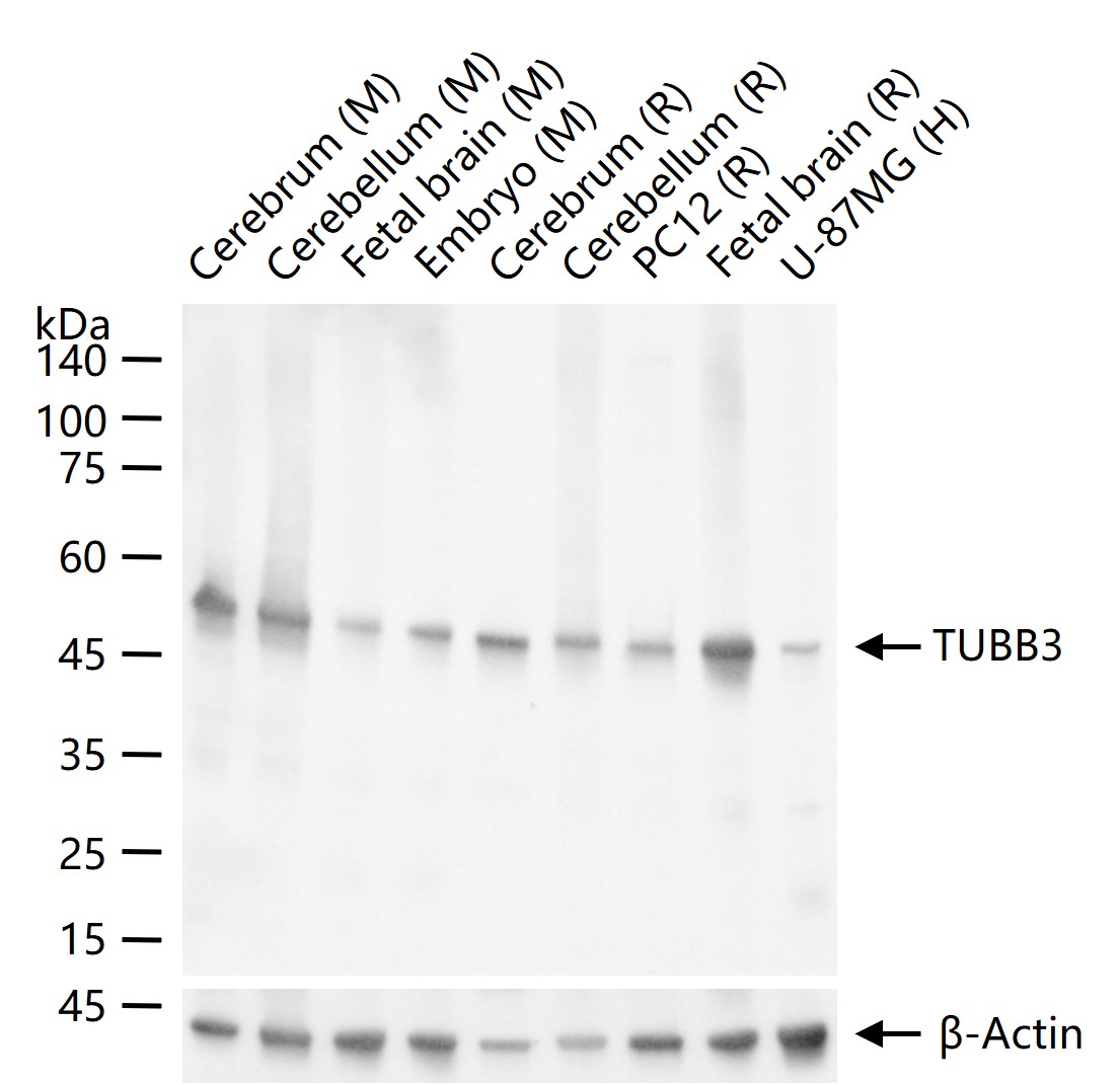 微管蛋白β3（神经标志物）单克隆抗体-bsm-33177M