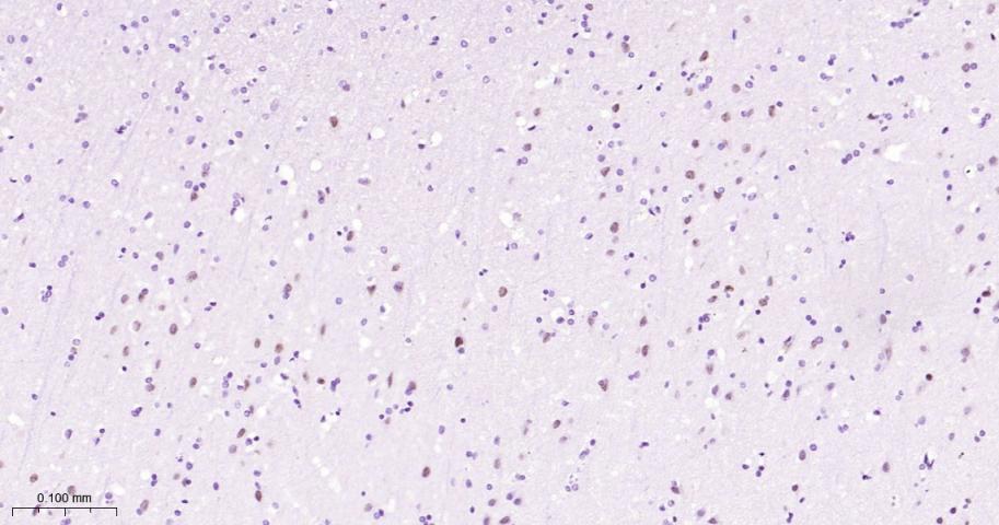 DNA结合蛋白2重组兔单抗