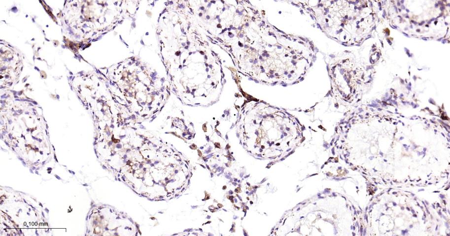 白细胞介素-13受体a1重组兔单抗