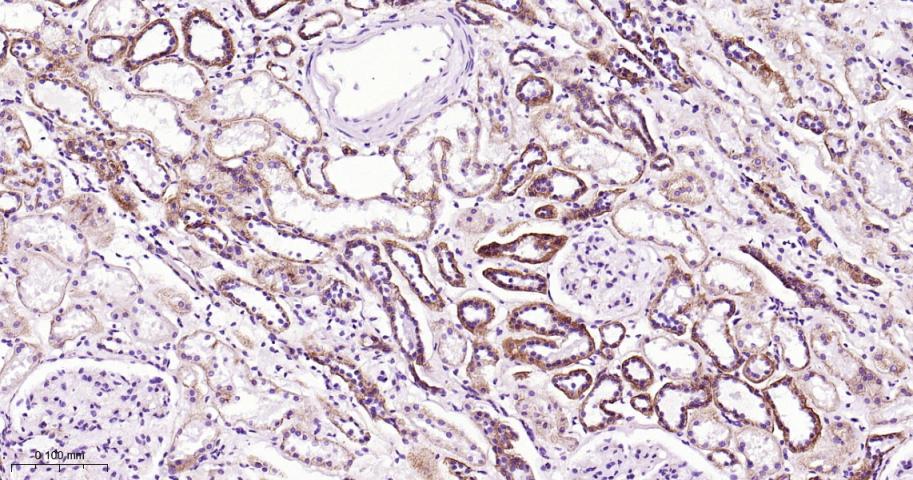 β-连环蛋白/β-连环素/β链接素重组兔单抗