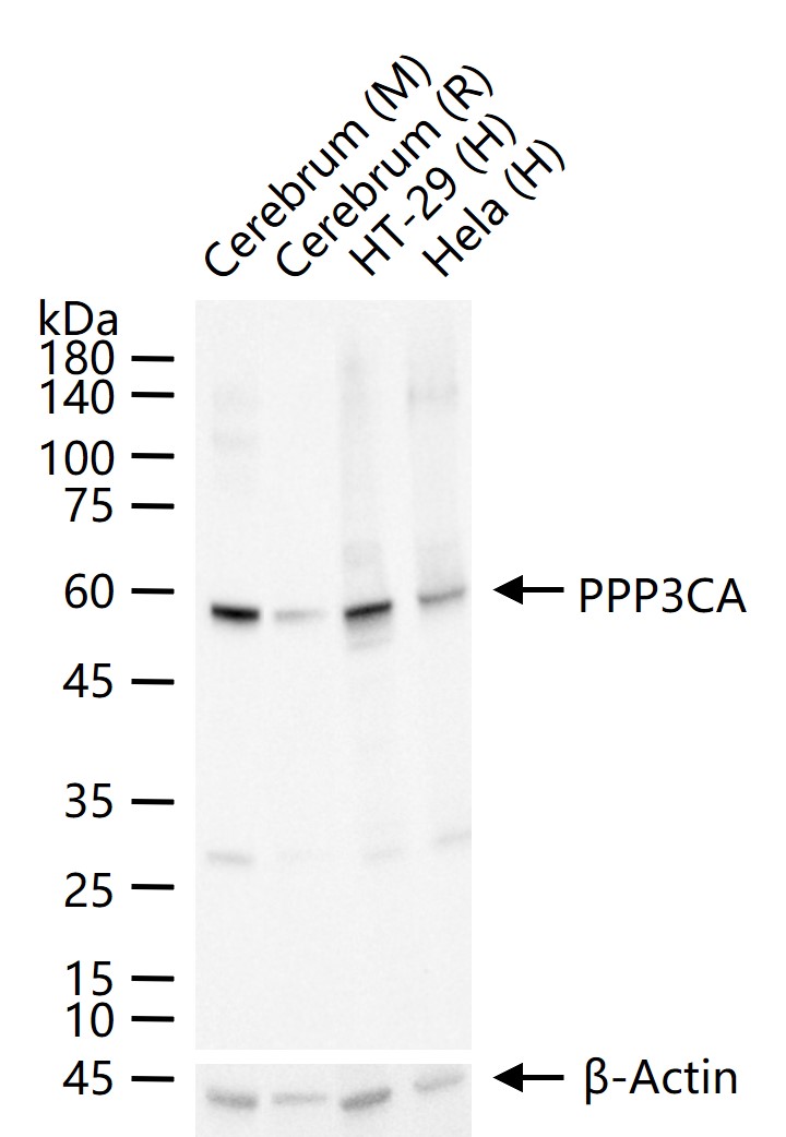 钙调磷酸酶A/钙依赖磷酸酶A重组兔单抗