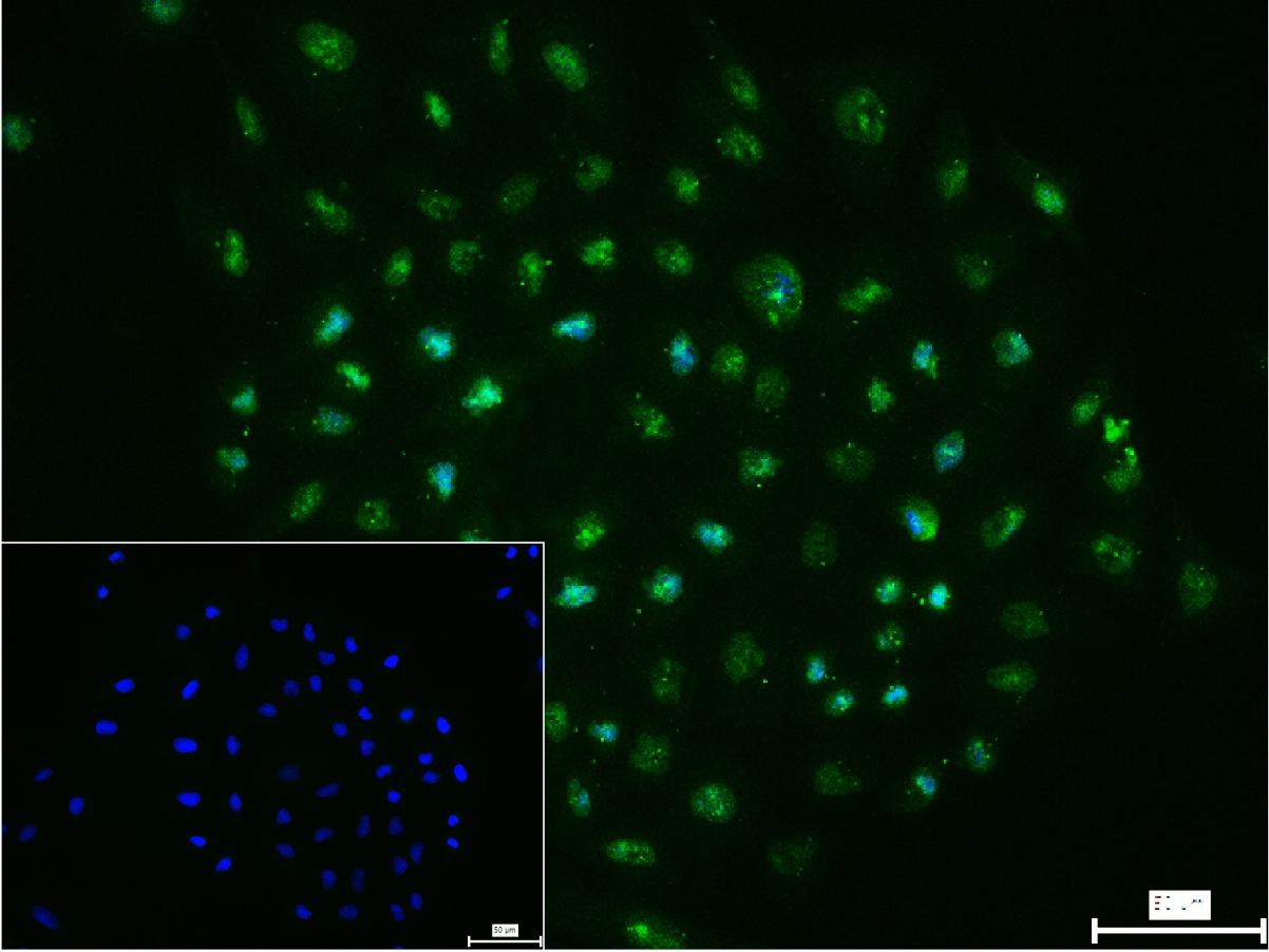 细胞核转录因子X盒结合蛋白重组兔单抗