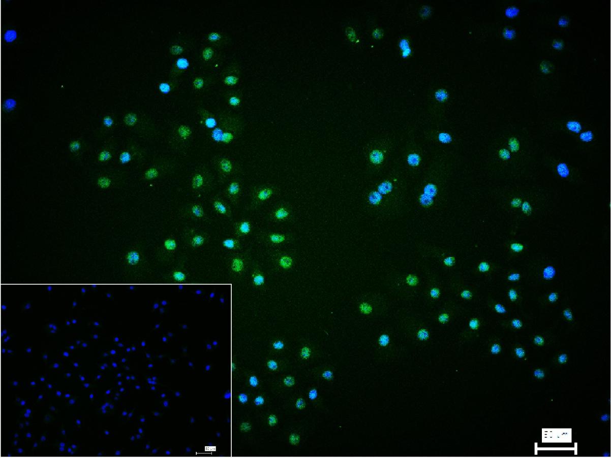 缺氧诱导因子1β/HIF-1β重组兔单抗