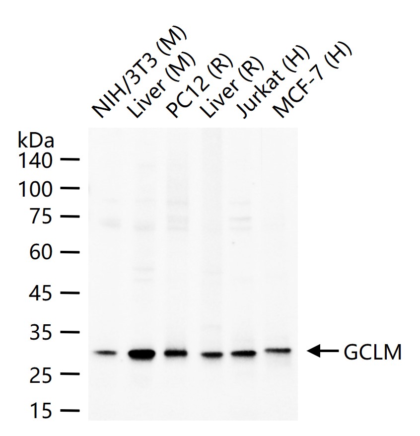 GCLM Recombinant Rabbit mAb (一抗) - WB | Bioss