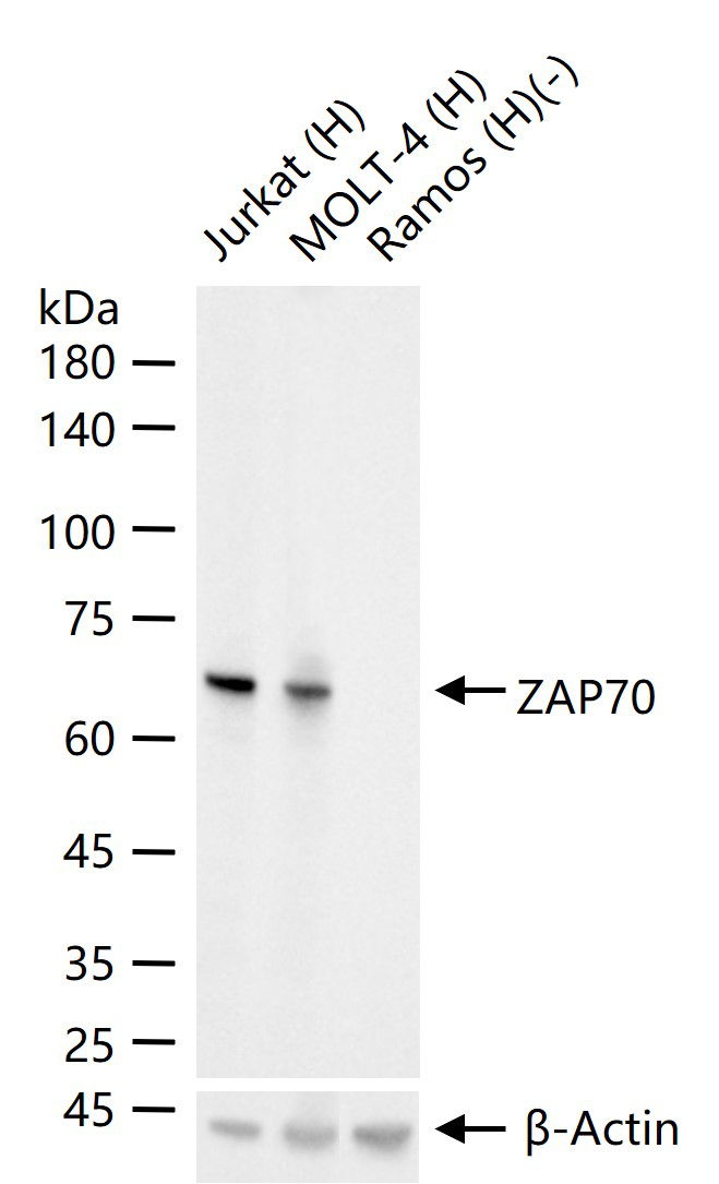 zeta相关蛋白70重组兔单抗