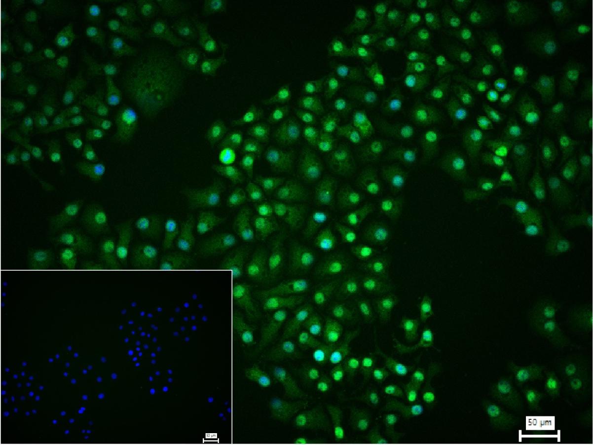 蛋白酶体PSMα1重组兔单抗-bsm-60572R