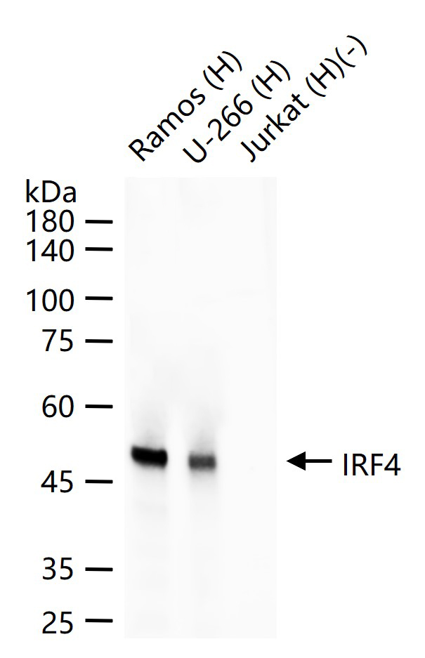 干扰素调节因子4重组兔单抗
