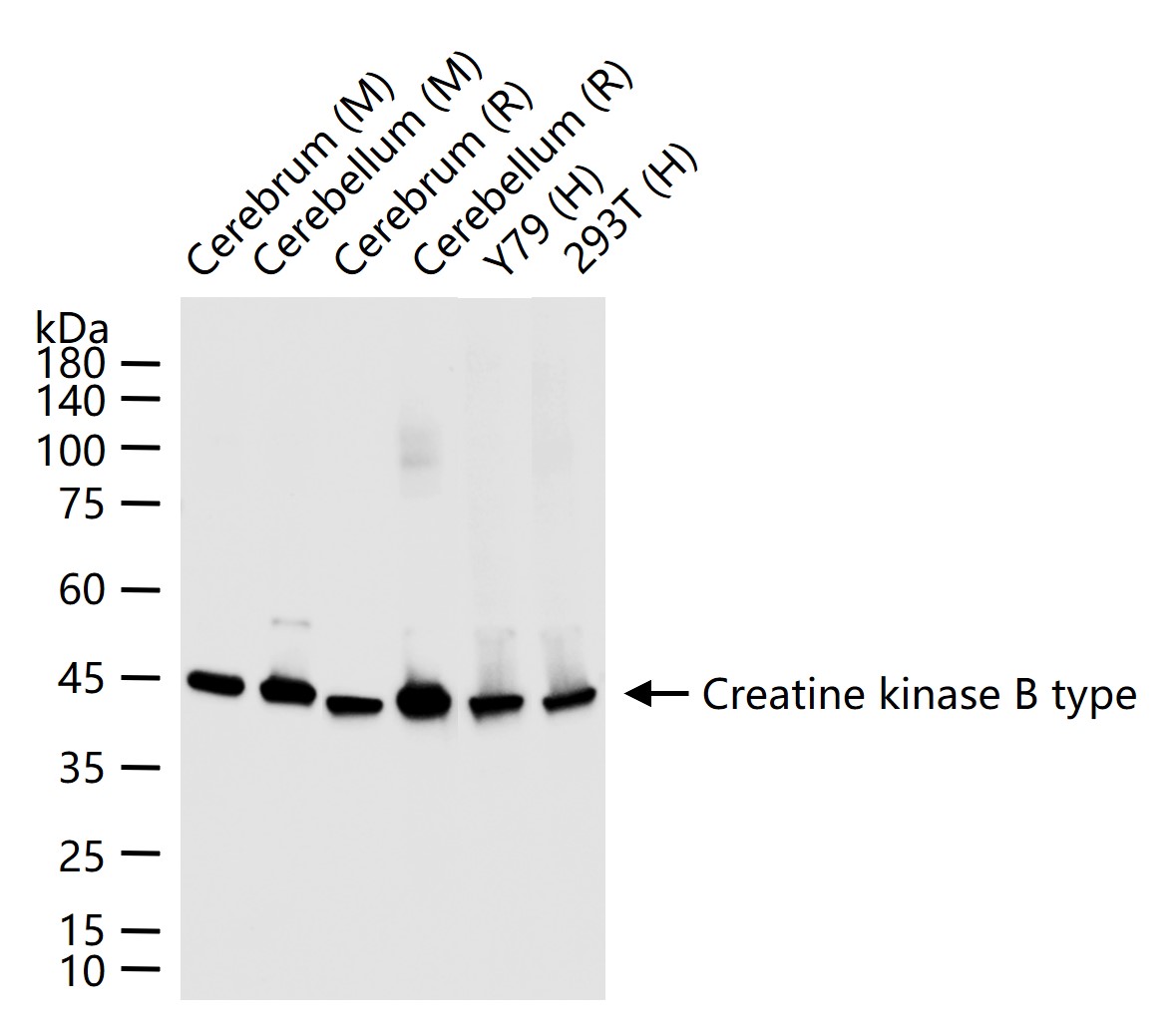 脑型肌酸激酶B型重组兔单抗