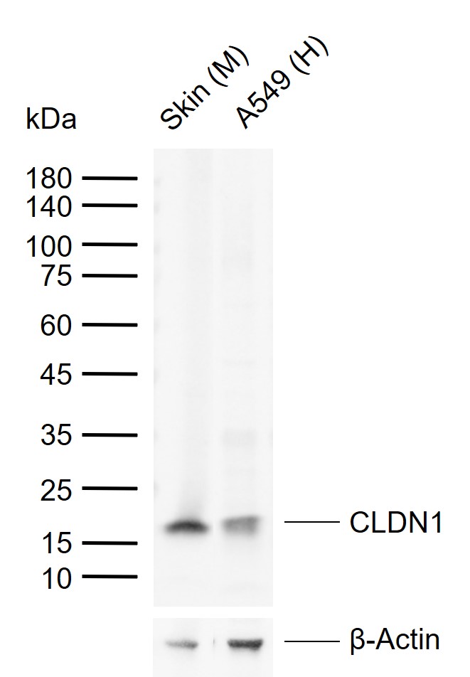 CLDN1 Rabbit pAb (一抗) - WB | Bioss