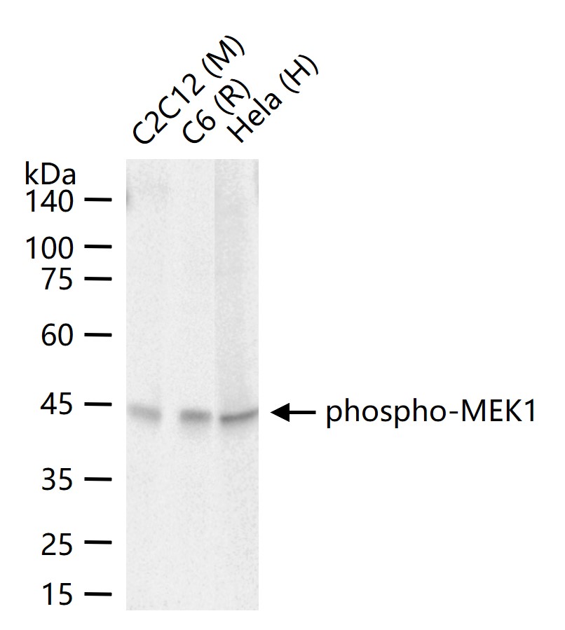 磷酸化丝裂原活化蛋白激酶激酶1重组兔单抗