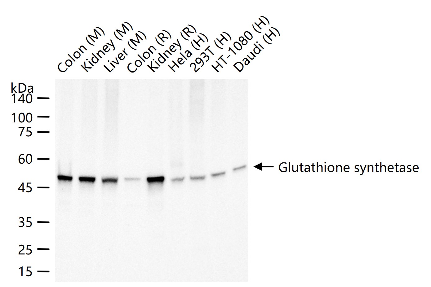 谷胱甘肽合成酶重组兔单抗
