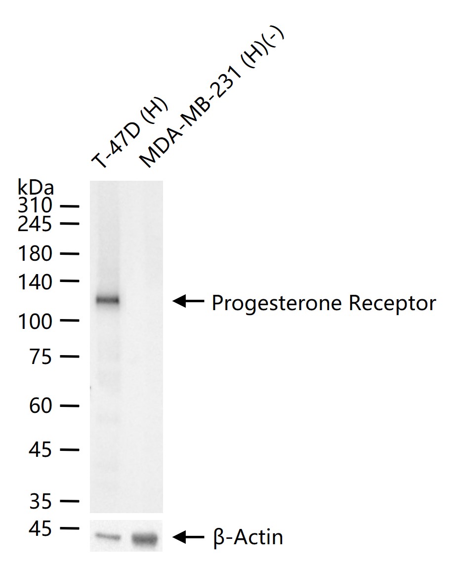孕激素受体重组兔单克隆抗体