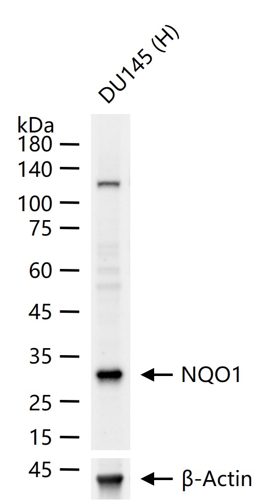 醌氧化还原酶抗体-bs-2184R