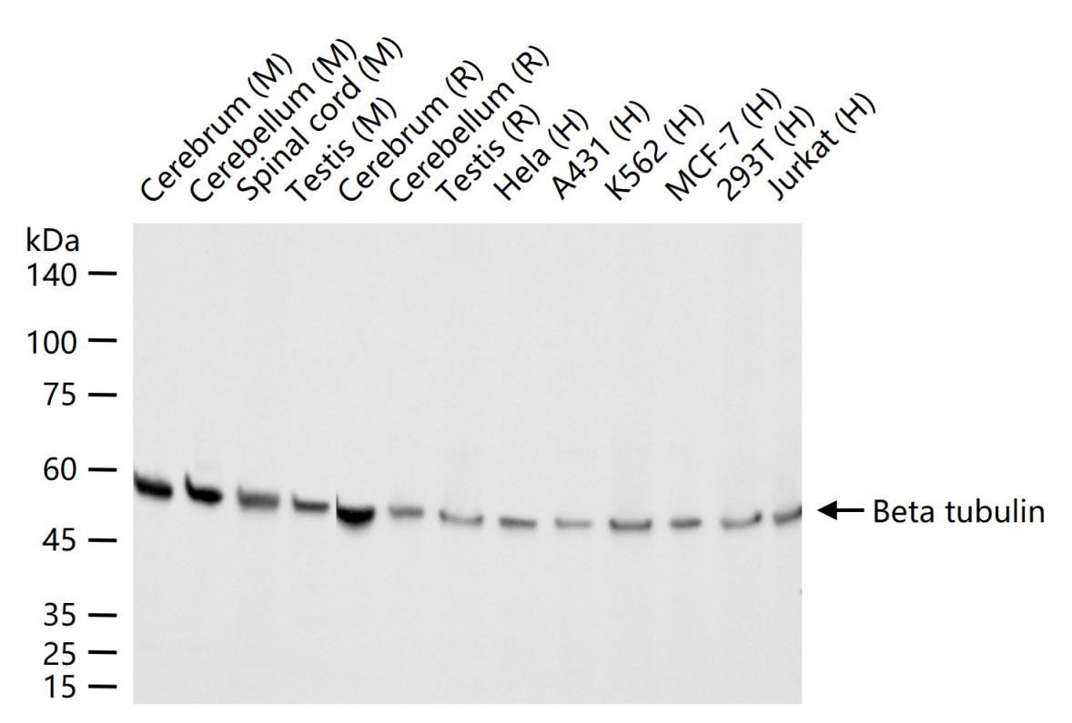 Beta tubulin Mouse mAb (一抗) - WB,IHC-P,IHC-F,IF | Bioss