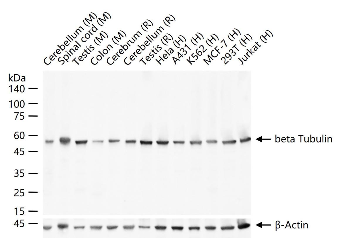 beta Tubulin Mouse mAb (一抗) - WB | Bioss