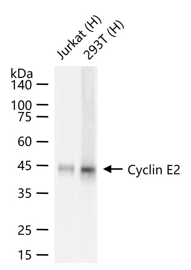 周期素E2重组兔单抗
