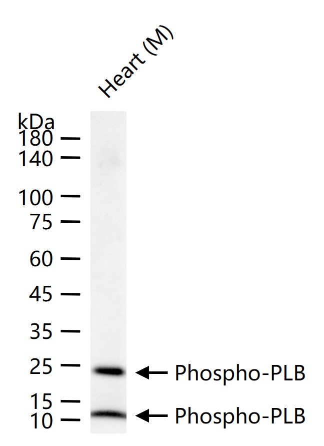 磷酸化心脏磷蛋白重组兔单抗