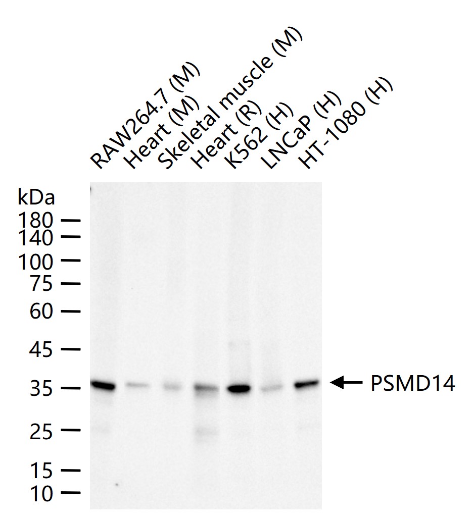 蛋白酶调解因子14重组兔单抗