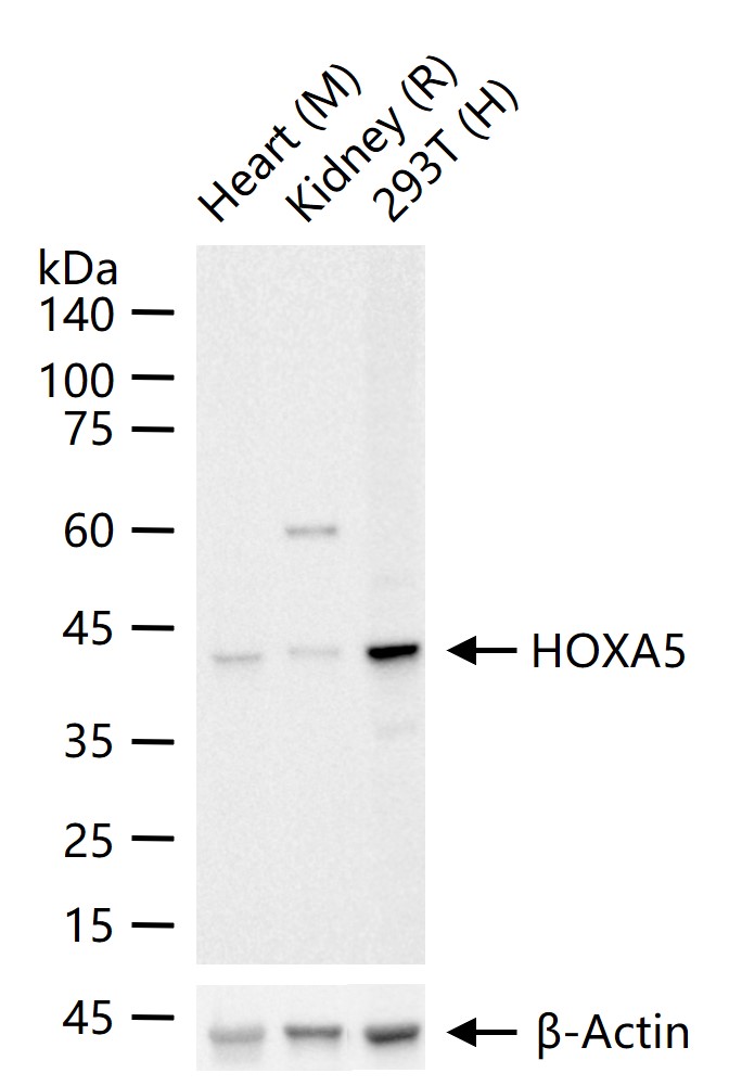 HOXA5 Recombinant Rabbit mAb (一抗) - WB | Bioss