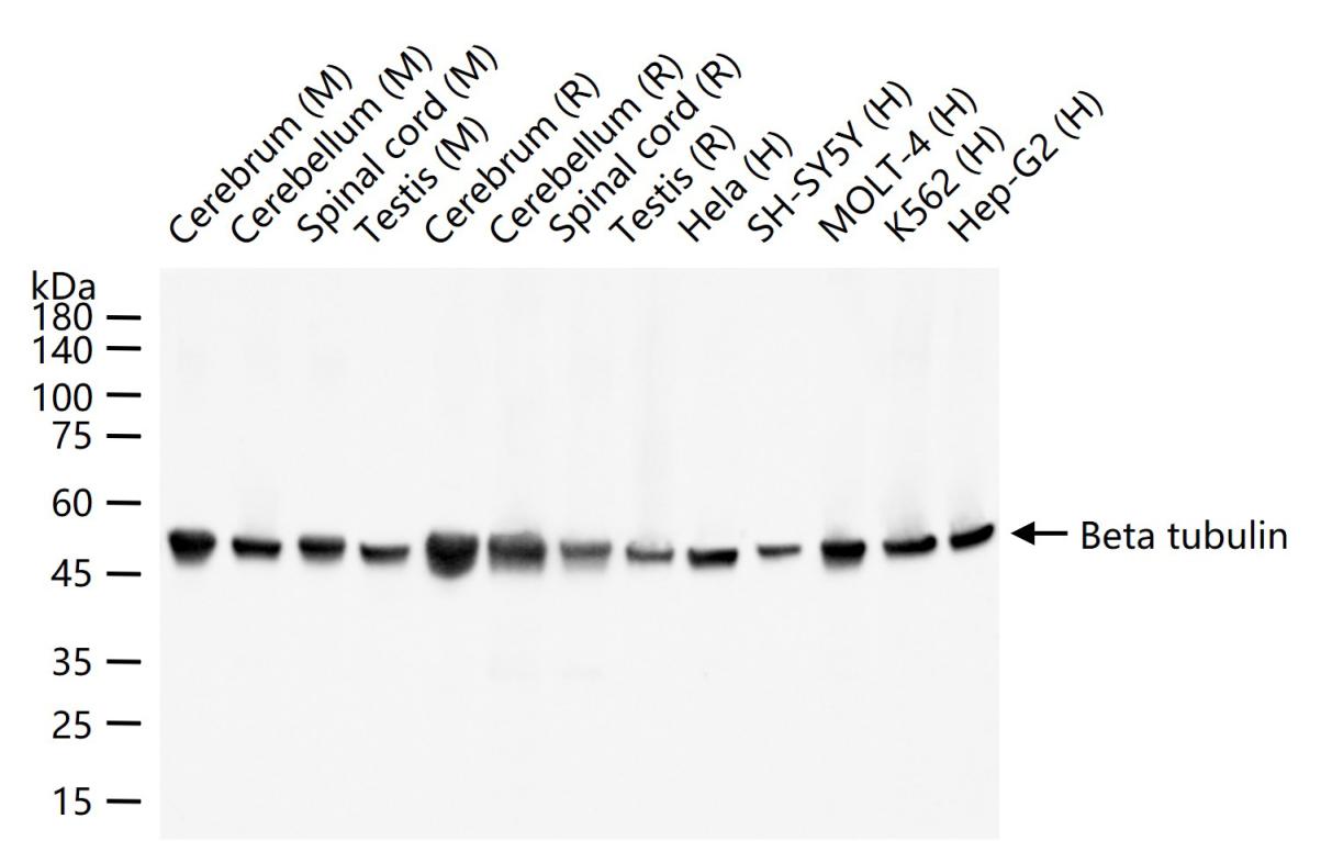 微管蛋白β tubulin/Tubulin β(内参)重组兔单抗