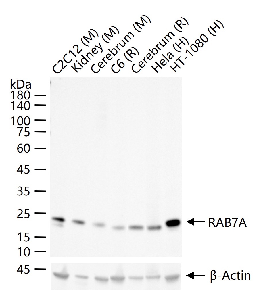 RAS癌基因相关蛋白RAB7重组兔单抗