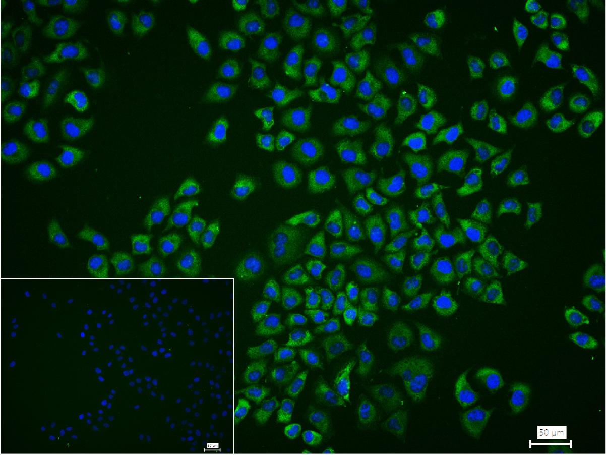 eIF4A1蛋白重组兔单抗