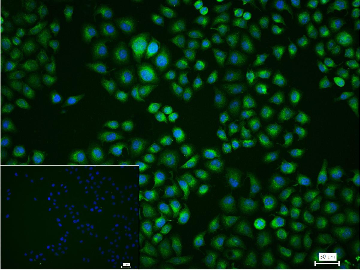 自噬相关蛋白4C重组兔单抗-bsm-61516R