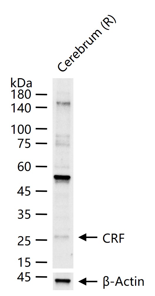 CRF Rabbit pAb (一抗) - WB | Bioss