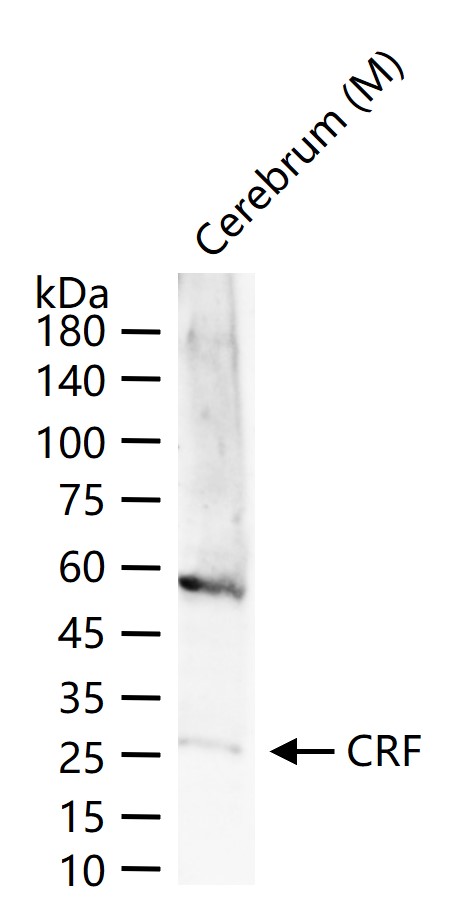 促肾上腺皮质激素释放因子/促肾上皮质激素释放激素抗体-bs-41044R
