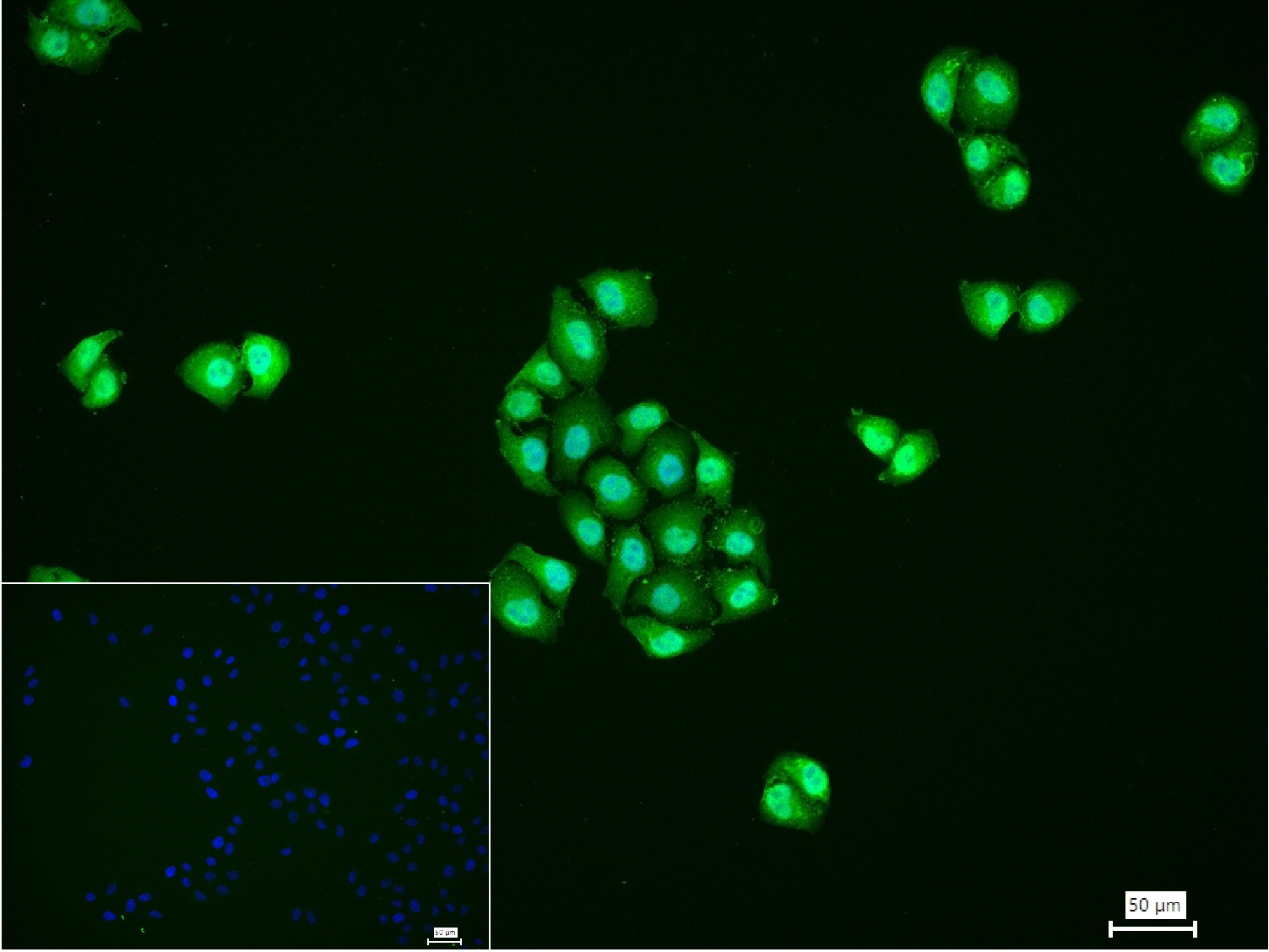 粘液样脂肪肉瘤蛋白FUS1重组兔单抗