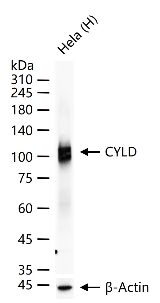 CYLD Mouse mAb (一抗) - WB,IHC-P,IHC-F,IF,ELISA | Bioss