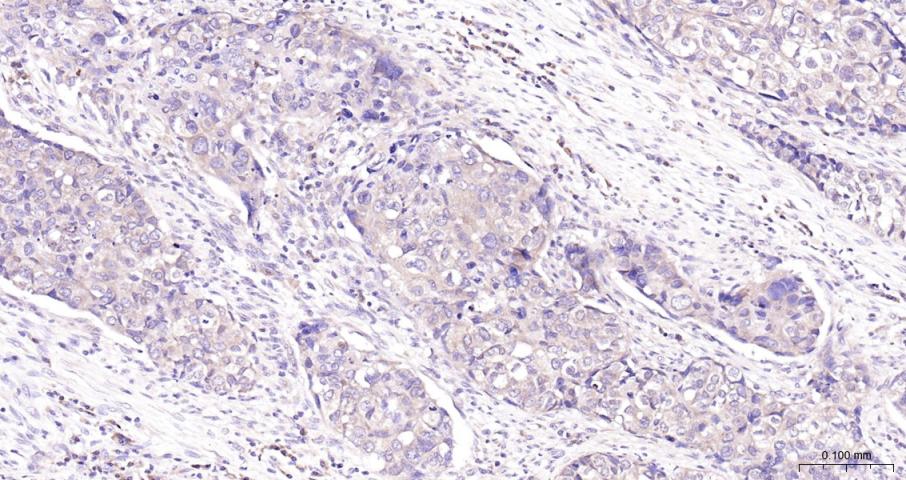 磷脂酰肌醇激酶（PI3Kβ）抗体-bs-10657R