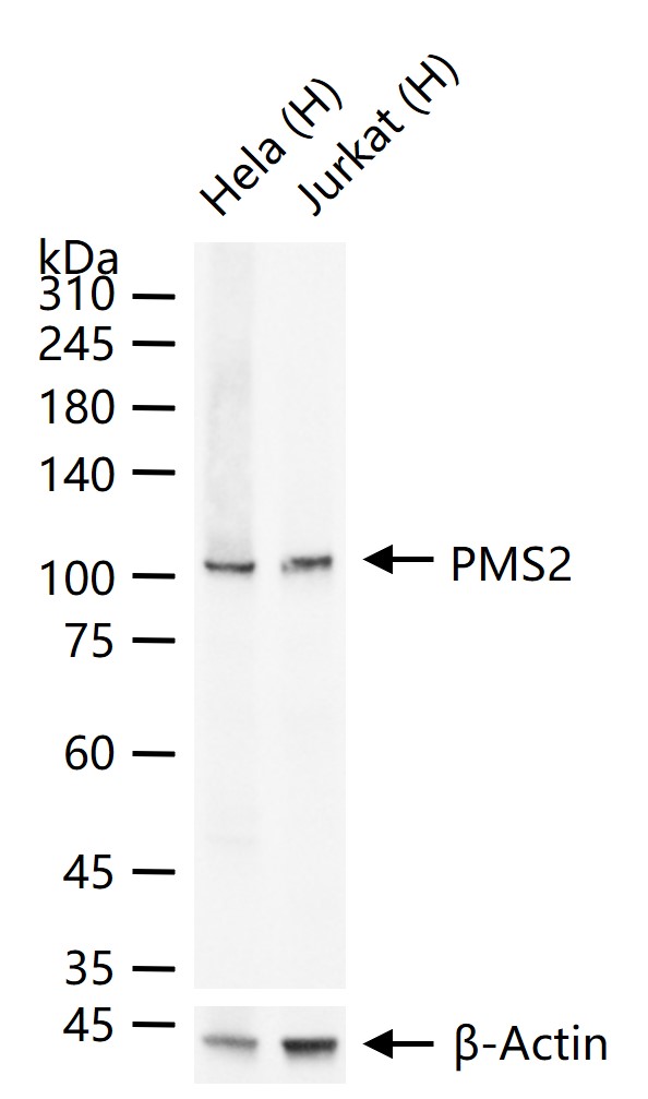肿瘤错配修复基因PMS2重组兔单抗