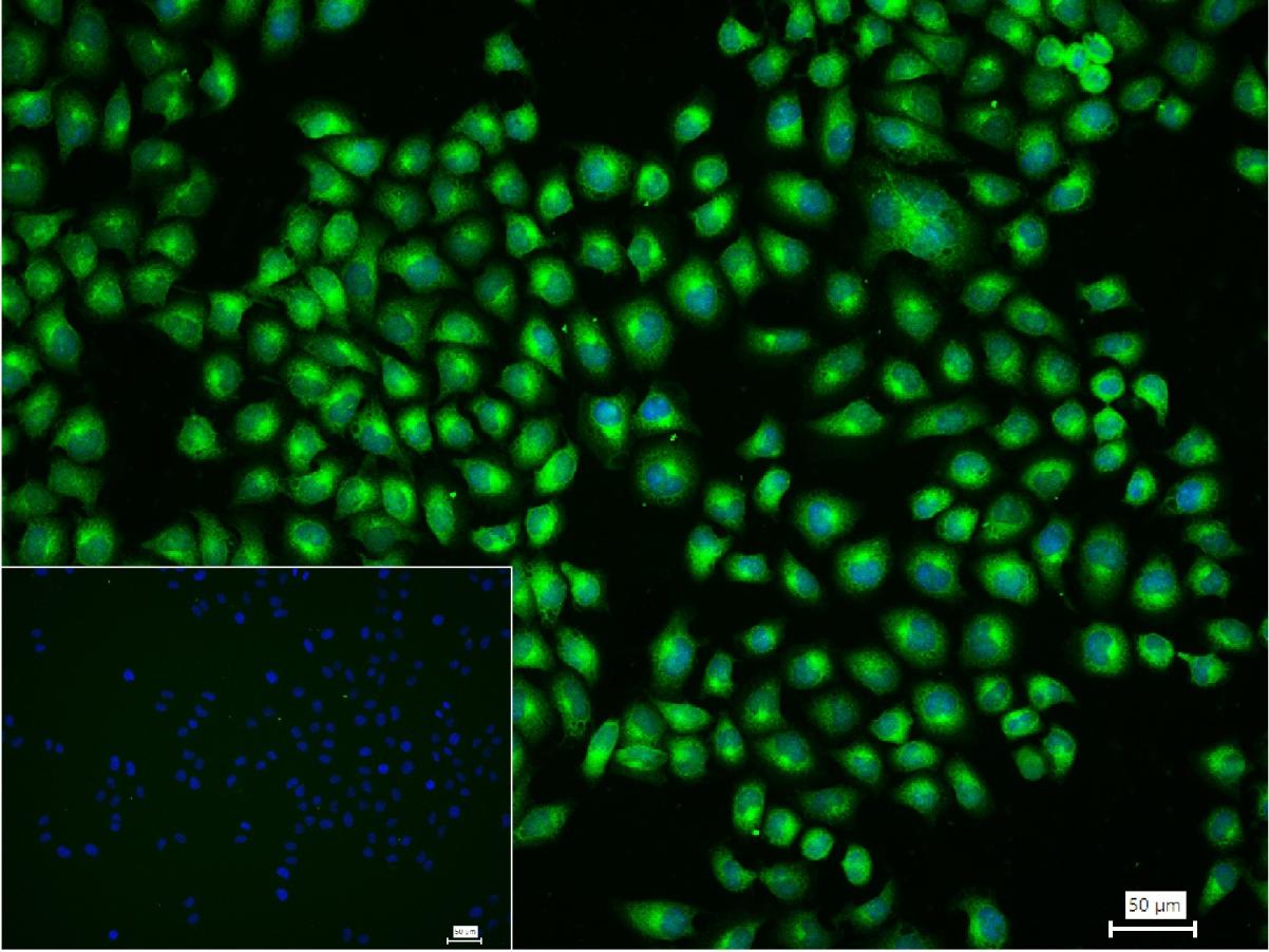 转铁蛋白受体(CD71)重组兔单抗