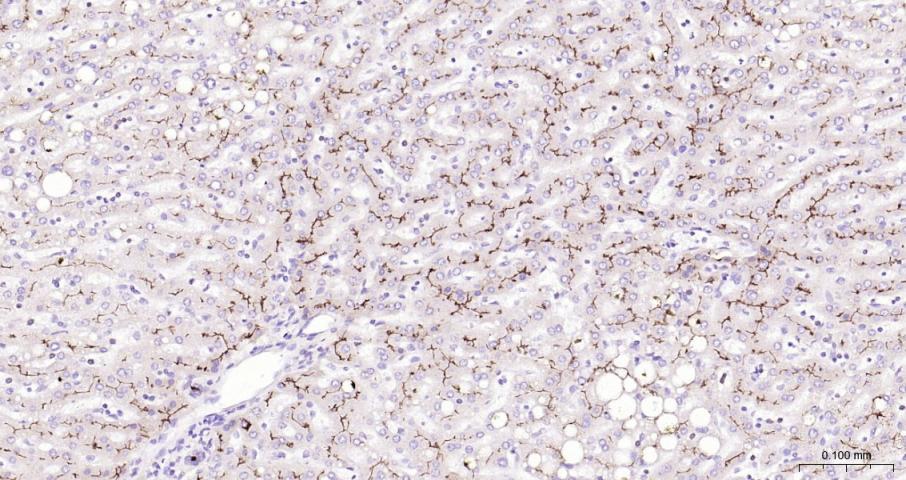 多药耐药蛋白/P-糖蛋白抗体-bs-0563R