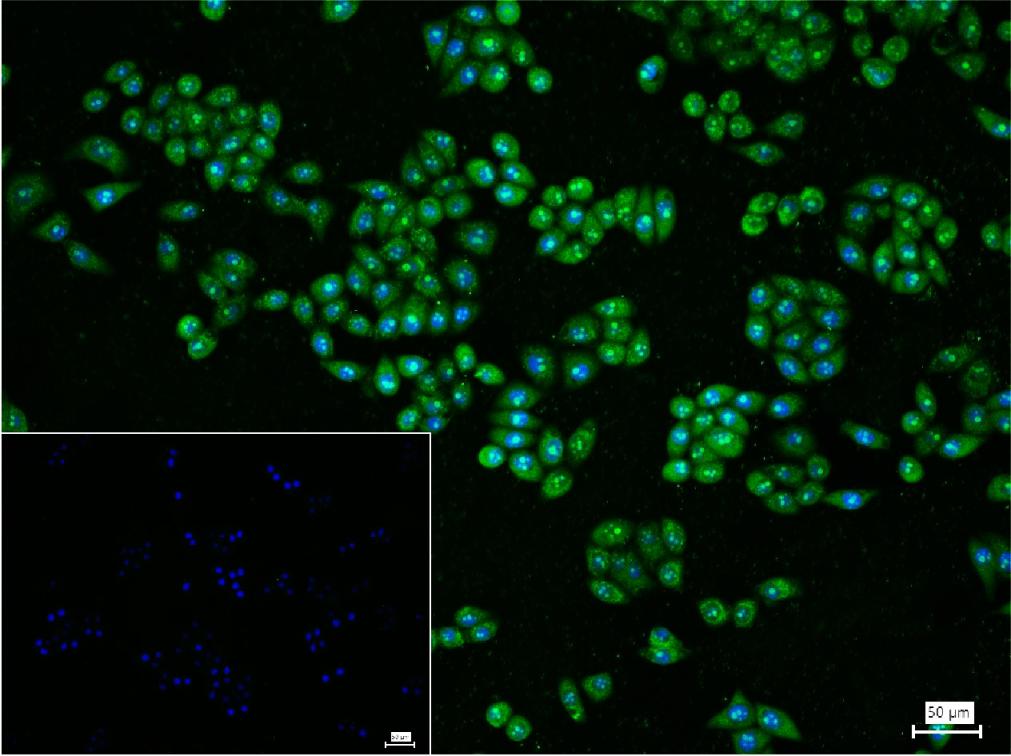 磷脂酰肌醇激酶（PI3Kβ）重组兔单抗