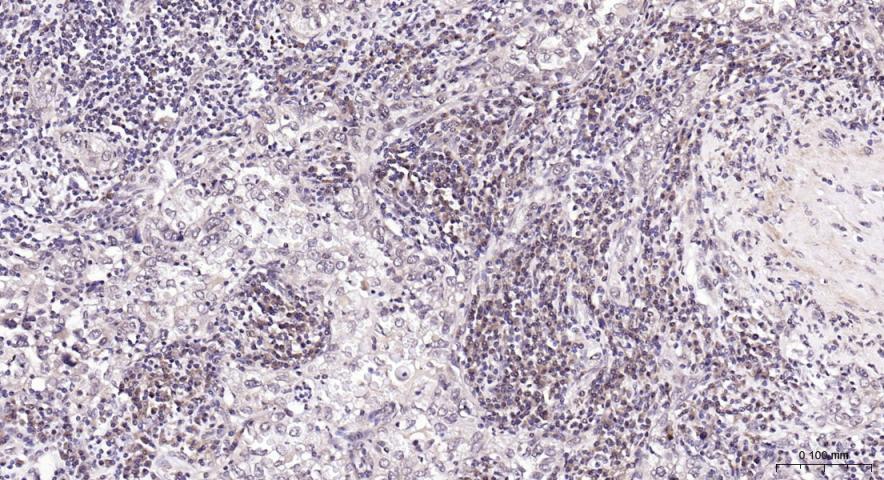 磷脂酰肌醇激酶（PI3Kβ）抗体-bs-10657R