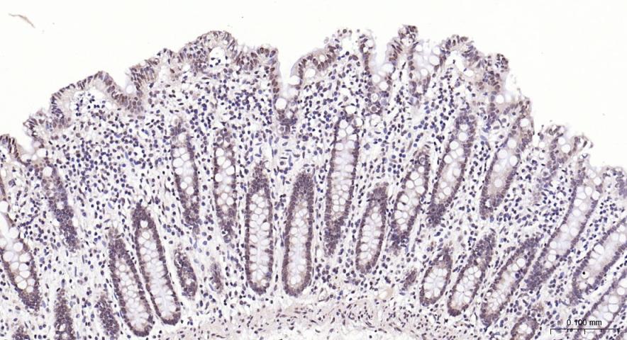 磷脂酰肌醇激酶（PI3Kβ）抗体-bs-10657R