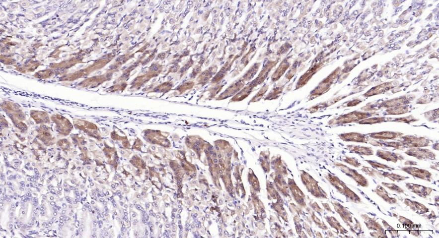 磷脂酰肌醇激酶（PI3Kβ）抗体-bs-10657R