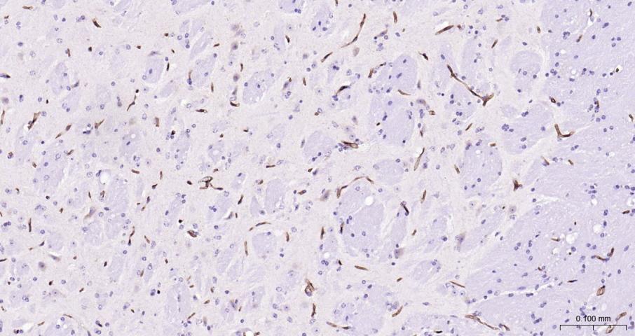 多药耐药蛋白/P-糖蛋白抗体-bs-0563R