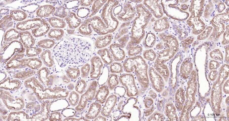 多药耐药蛋白/P-糖蛋白抗体-bs-0563R