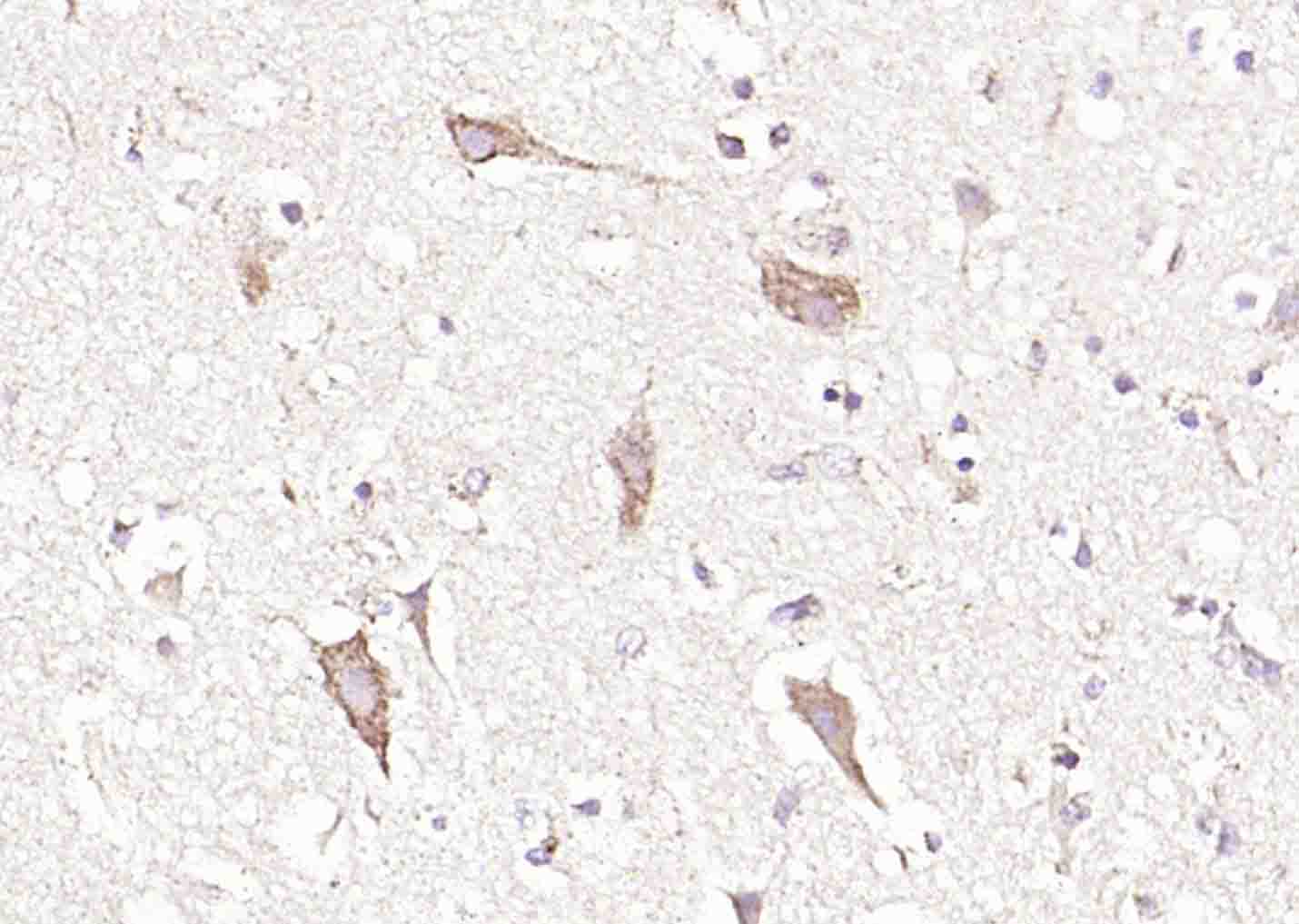 溶质转运蛋白家族44成员1抗体-bs-3667R