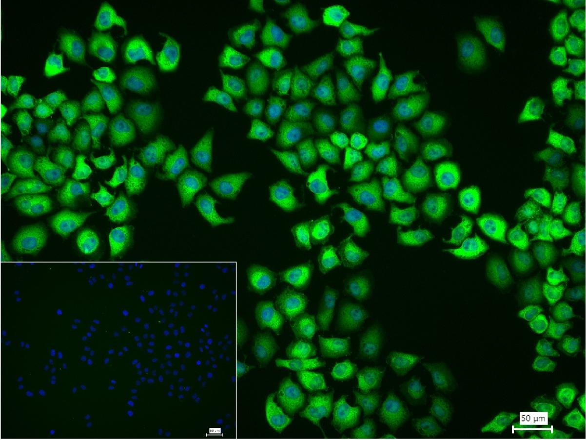 热休克蛋白90β/HSP90 β 重组兔单抗
