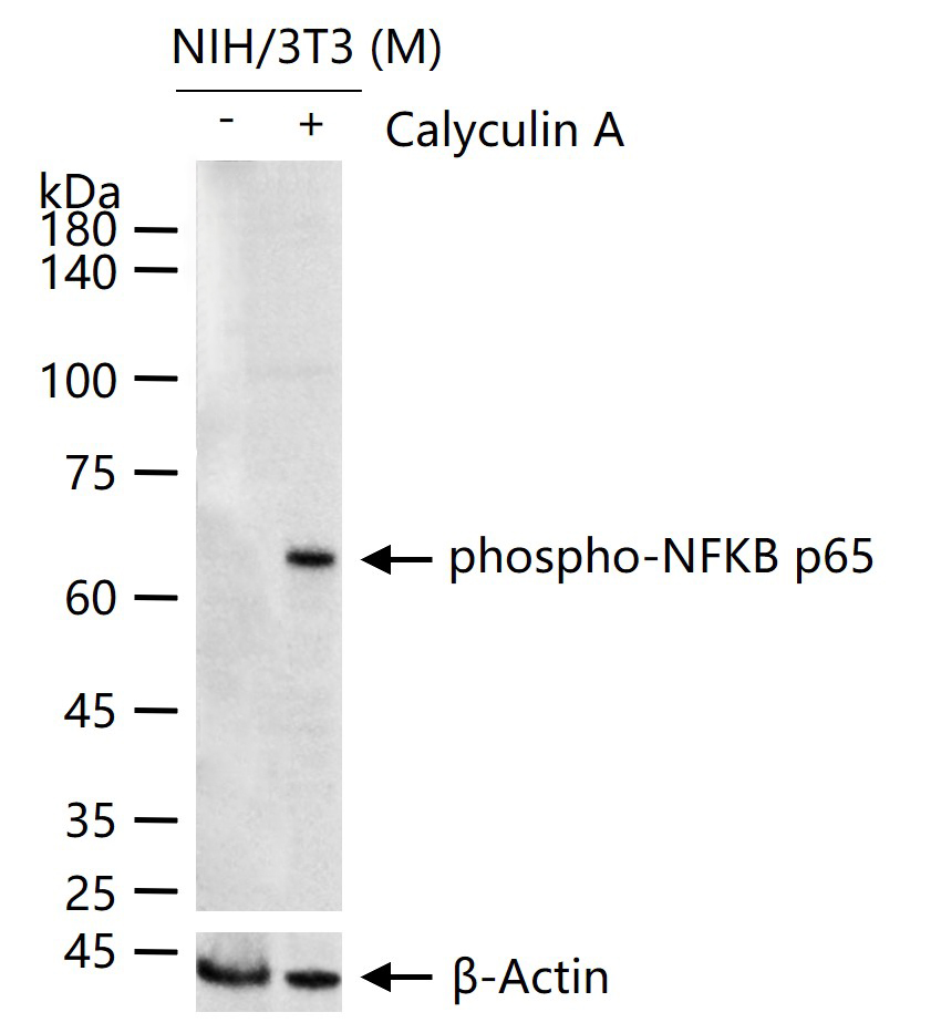 phospho-NFKB p65 (Ser536) Rabbit pAb (一抗) - WB | Bioss