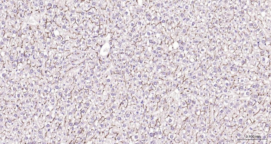 多药耐药蛋白/P-糖蛋白抗体-bs-0563R