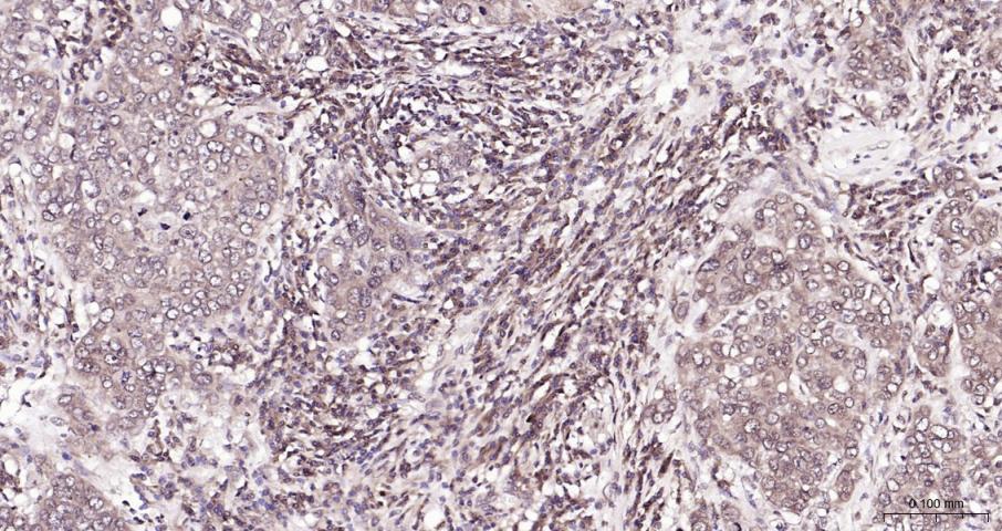磷脂酰肌醇激酶（PI3Kβ）抗体-bs-10657R